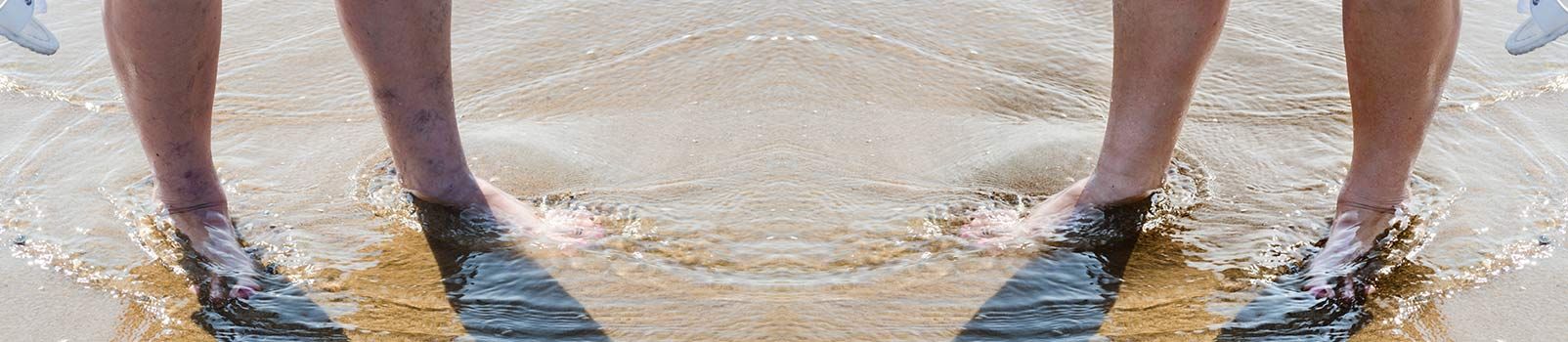 e-possivel-aproveitar-o-Verao-sem-varizes